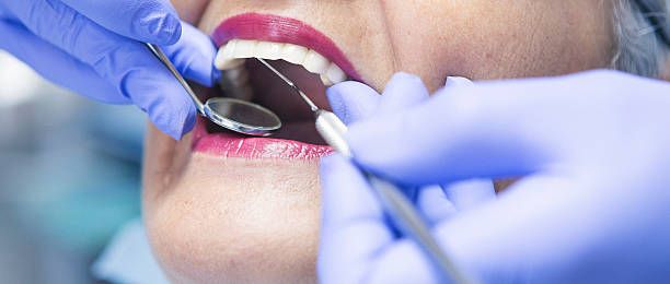 Best Dental Abscess Treatment in Hidden Valley, IN